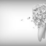 היתרונות של ביטוח שיניים 